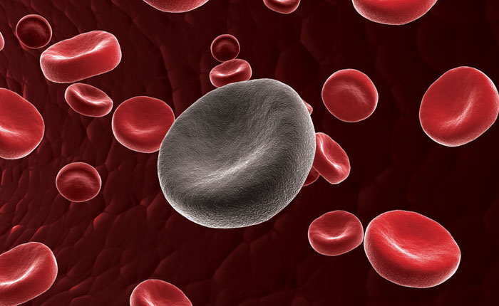 ¿Por qué los hombres tienen mayor riesgo de desarrollar leucemia?