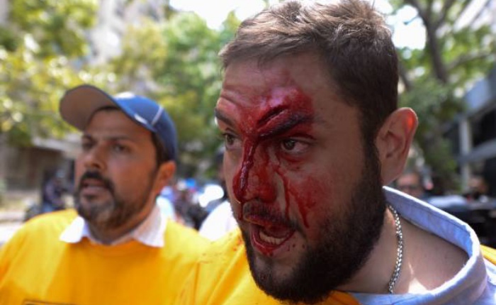 Requesens-GettyImages