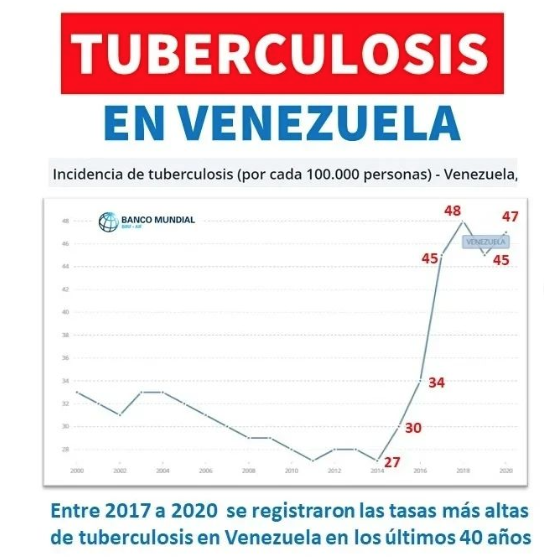 Tuberculosis