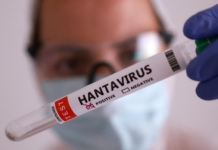 hantavirus Anzoátegui