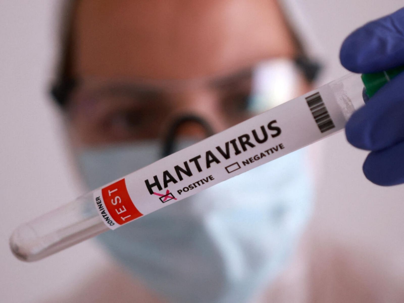 hantavirus Anzoátegui